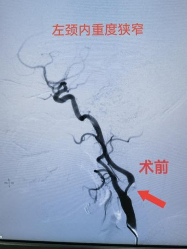 神经外科1.png