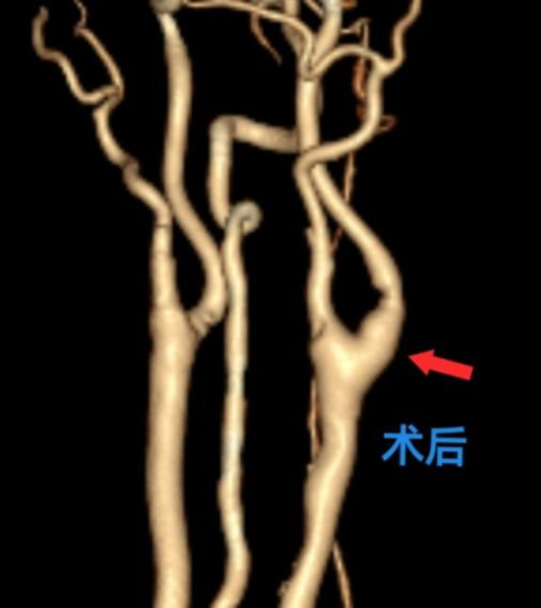 神经外科2.png