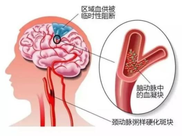 神经外科5.png