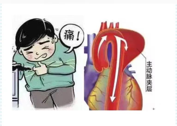 血管4.jpg